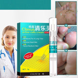 Universal Hand And Foot Calluses And Thorns Care Agent