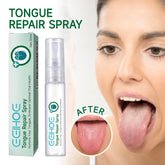 Curing Tongue Coating Whitening Relieving Tongue Cracking Swelling Oral Care Spray
