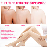 Women's Skin Pigmentation Care