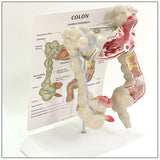 Medical Human Anatomical Intestine Model